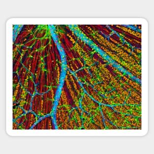 Retina blood vessels and nerve cells (P424/0244) Sticker